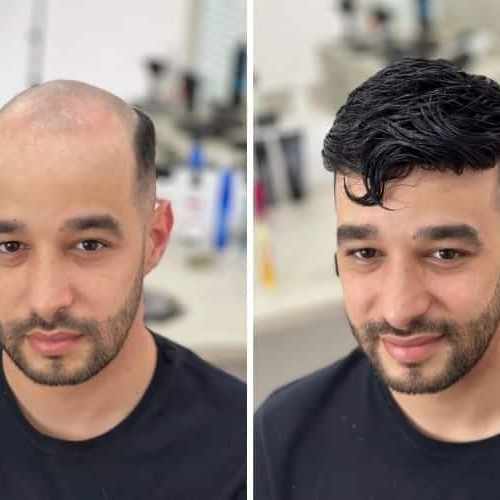 photo of Mens Hair Systems - the Best Products at 1177 Goldfinch Lane Anne Arundel County MD 21108