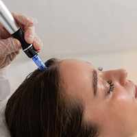 Exosomes Therapy for Hair Loss in Riyadh